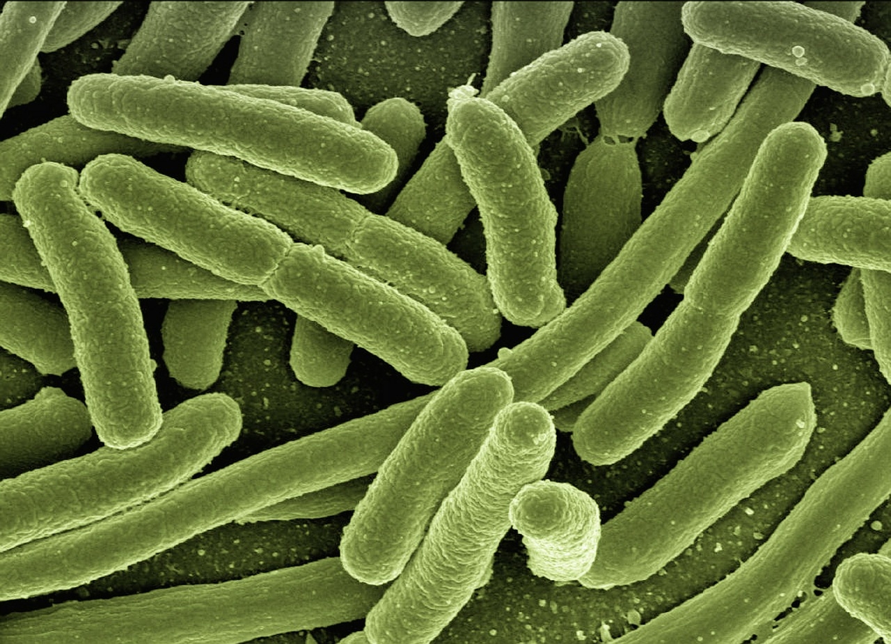 Another dangerous bacteria scope discovery? Now it's Pasadena - MyNewsLA.com